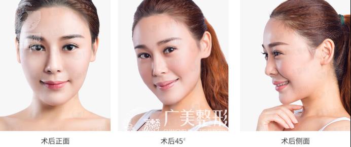 1523413961351070754.png 精致翘鼻 给整个面部锦上添花455.png
